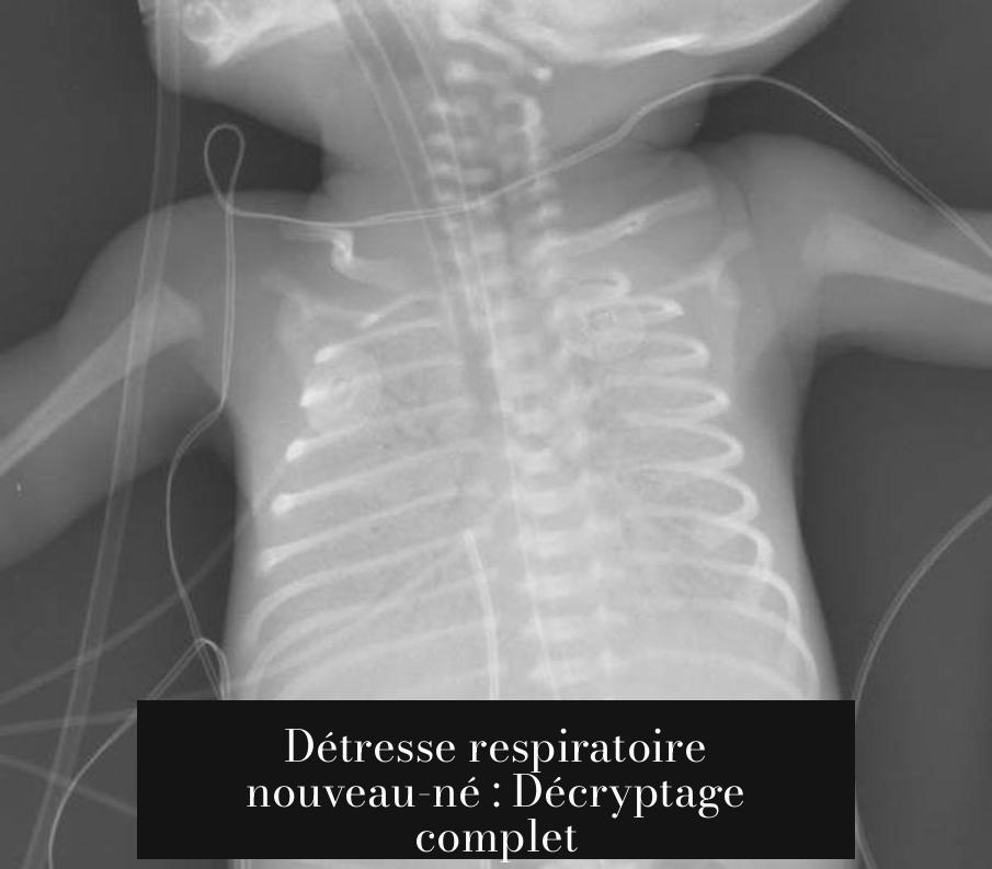 Détresse respiratoire nouveau-né : Décryptage complet
