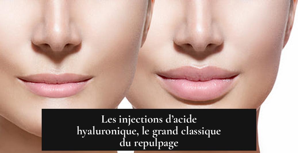 Les injections d’acide hyaluronique, le grand classique du repulpage