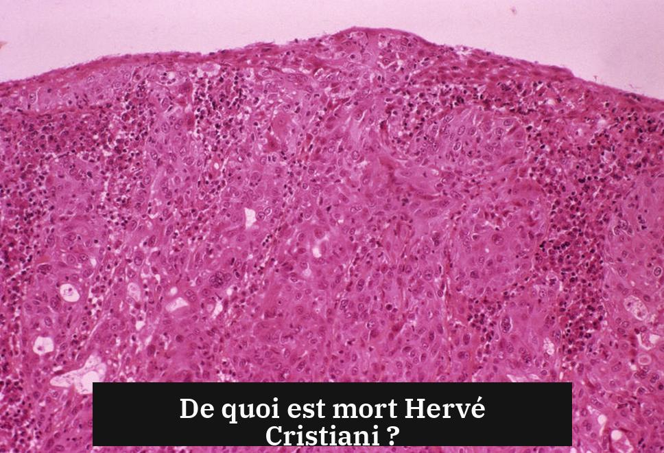 De quoi est mort Hervé Cristiani ?