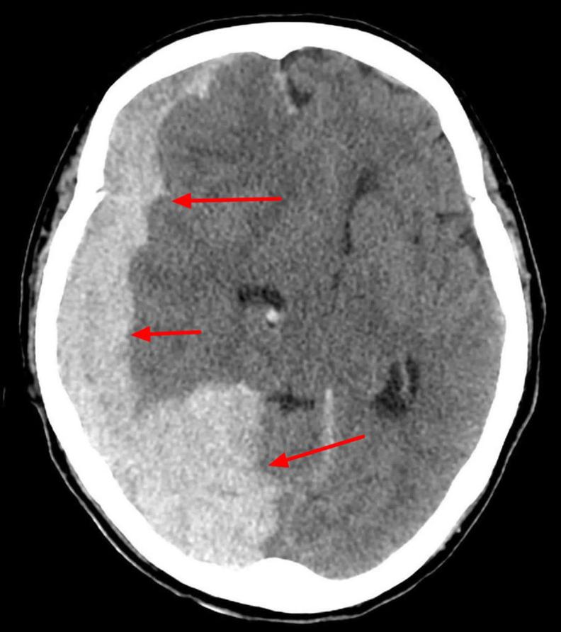 Diagnostic : scanner ou rien
