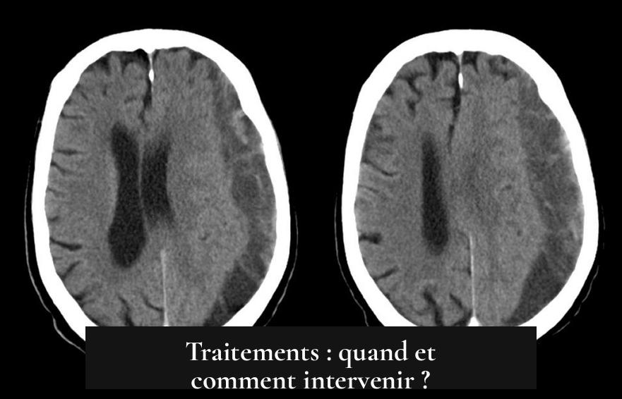 Traitements : quand et comment intervenir ?