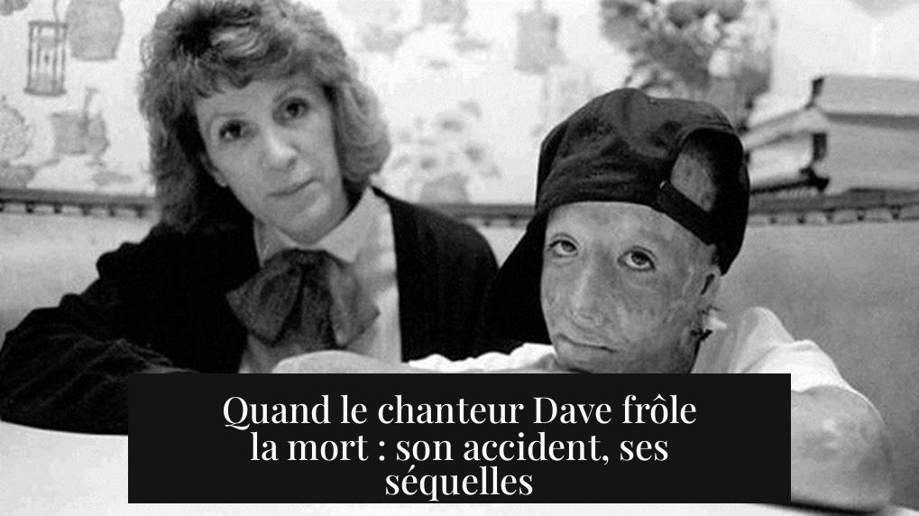 Quand le chanteur Dave frôle la mort : son accident, ses séquelles