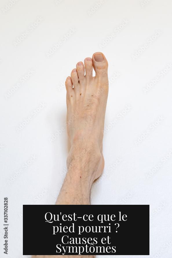 Qu'est-ce que le pied pourri ? Causes et Symptômes