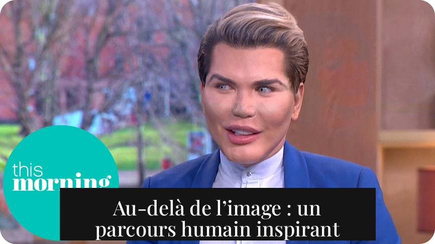 Au-delà de l’image : un parcours humain inspirant