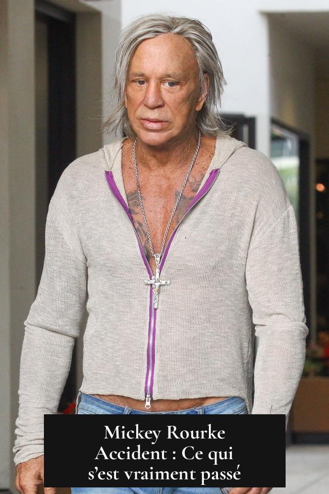 Mickey Rourke Accident : Ce qui s’est vraiment passé