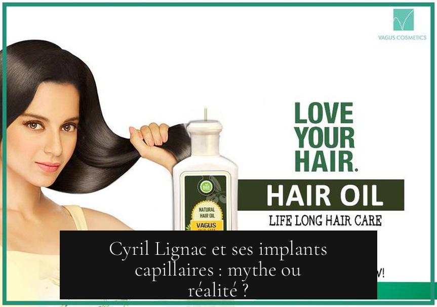 Cyril Lignac et ses implants capillaires : mythe ou réalité ?