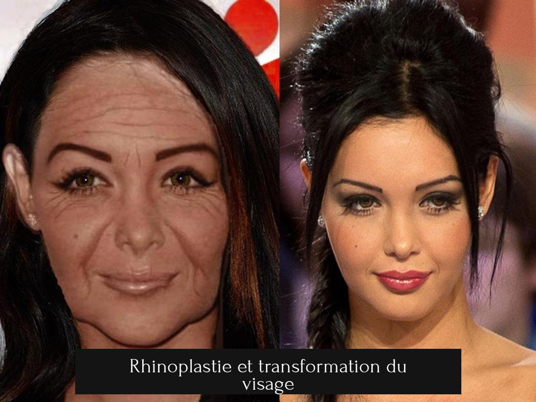 Rhinoplastie et transformation du visage