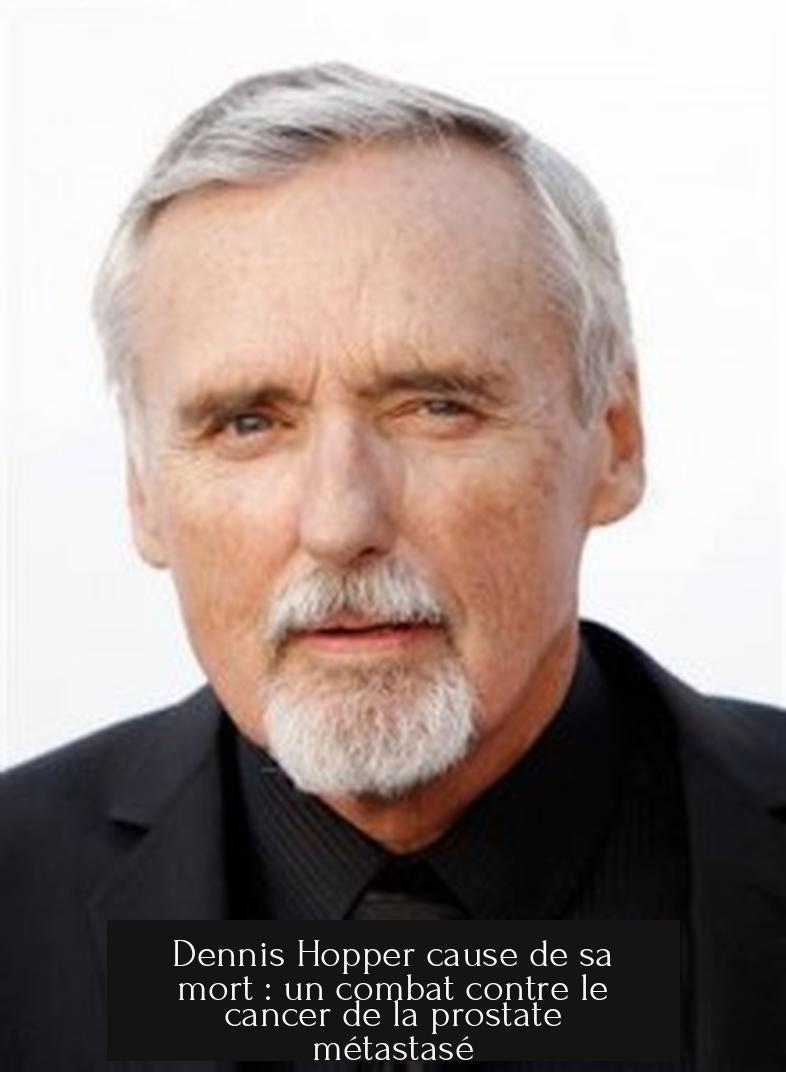 Dennis Hopper cause de sa mort : un combat contre le cancer de la prostate métastasé