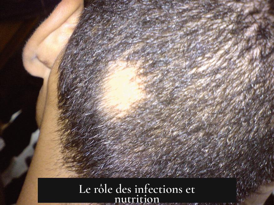 Le rôle des infections et nutrition