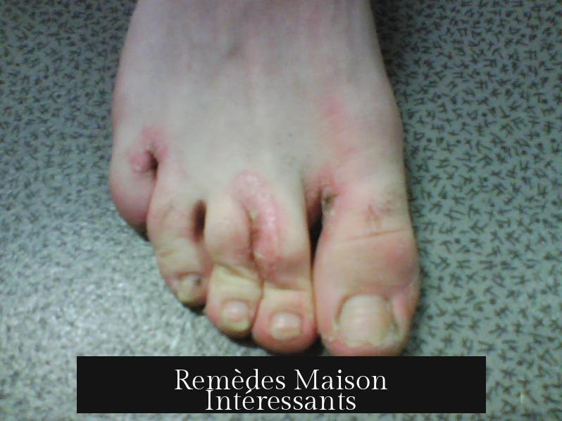 Remèdes Maison Intéressants