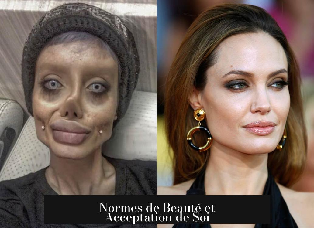 Normes de Beauté et Acceptation de Soi